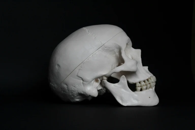 TMJD for clients with jaw pain, headaches and limited jaw mobility.